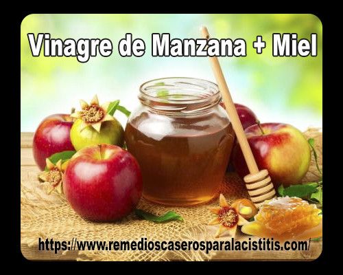Vinagre de manzana y miel para prevenir la infección urinaria